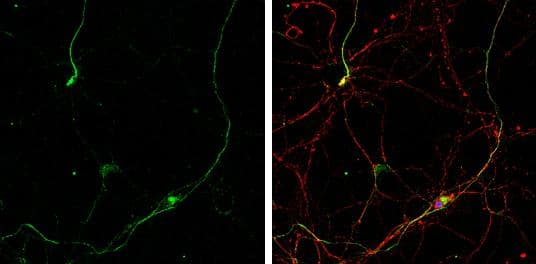 Gephyrin antibody [N2C1], Internal detects Gephyrin protein by immunofluorescent analysis.Sample: DIV10 rat E18 primary hippocampal neurons were fixed in 4% paraformaldehyde at RT for 15 min.Green: Gephyrin protein stained by Gephyrin antibody [N2C1], Internal (NBP2-16641) diluted at 1:500.Red: beta Tubulin 3/ Tuj1, stained by beta Tubulin 3/ Tuj1 antibody [GT1338]  diluted at 1:500.Blue: Fluoroshield with DAPI . 