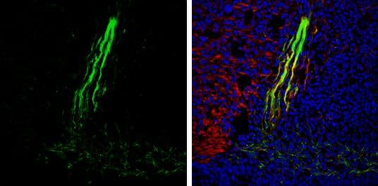 Gephyrin antibody [N2C1], Internal detects Gephyrin protein expression by immunohistochemical analysis.Sample: Frozen sectioned E13.5 Rat brain. Green: Gephyrin protein stained by Gephyrin antibody [N2C1], Internal (NBP2-16641) diluted at 1:250.Red: beta Tubulin 3/ TUJ1, a mature neuron marker, stained by beta Tubulin 3/ TUJ1 antibody [GT11710]  diluted at 1:500.Blue: Fluoroshield with DAPI . 