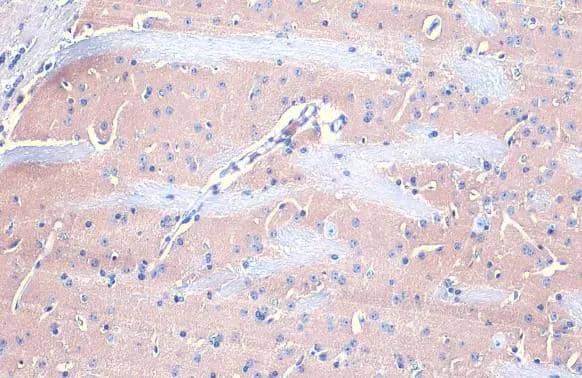 Gephyrin antibody [N2C1], Internal detects Gephyrin protein at cytoplasm by immunohistochemical analysis.Sample: Paraffin-embedded mouse brain.Gephyrin stained by Gephyrin antibody [N2C1], Internal (NBP2-16641) diluted at 1:500.Antigen Retrieval: Citrate buffer, pH 6.0, 15 min 