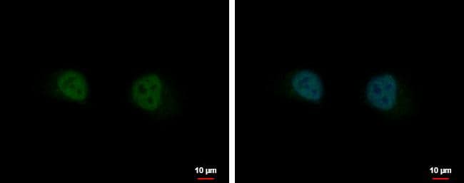 Immunocytochemistry/ Immunofluorescence GIT2 Antibody - BSA Free