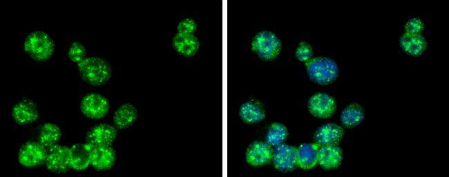 Immunocytochemistry/ Immunofluorescence GLMN Antibody