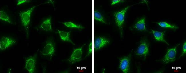 GLUD1 + GLUD2 antibody detects GLUD1 + GLUD2 protein at mitochondria by immunofluorescent analysis.Sample: HeLa cells were fixed in ice-cold MeOH for 5 min.Green: GLUD1 + GLUD2 protein stained by GLUD1 + GLUD2 antibody (NBP2-16678) diluted at 1:500.Blue: Hoechst 33342 staining.Scale bar = 10 um. 