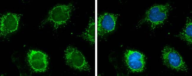 GLUD1+ GLUD2 antibody detects Glutamate Dehydrogenase protein at mitochondria by immunofluorescent analysis.Sample: HeLa cells were fixed in ice-cold MeOH for 5 min.Green: Glutamate Dehydrogenase protein stained by GLUD1 + GLUD2 antibody (NBP2-16679) diluted at 1:500.Blue: Hoechst 33342 staining. 