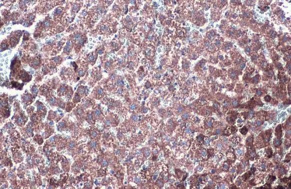 Western Blot: Glutamate Dehydrogenase Antibody [NBP2-16679] - Metabolic alterations in the MPC1-/- cells expressed significantly higher levels glutaminolysis related proteins GDH (Glutamate Dehydrogenase) and GLS (NBP2-29940), but there was no significant change in the PDHE1 protein expression in these cells as shown in representative western blots. The alpha-Tublin was used as loading control. ***PSample: Paraffin-embedded rat liver.Glutamate Dehydrogenase stained by GLUD1 + GLUD2 antibody (NBP2-16679) diluted at 1:500.Antigen Retrieval: Citrate buffer, pH 6.0, 15 min 