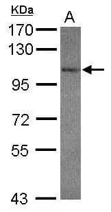 Sample (30 ug of whole cell lysate)  A: NT2D1  7.5% SDS PAGE  NBP2-16681 diluted at 1:1000  