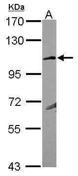 Sample (30 ug of whole cell lysate) A: MCF-77.5% SDS PAGE NBP2-16682 diluted at 1:1000  