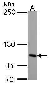 Sample (30 ug of whole cell lysate)  A: NT2D1  5% SDS PAGE  NBP2-16683 diluted at 1:2000  
