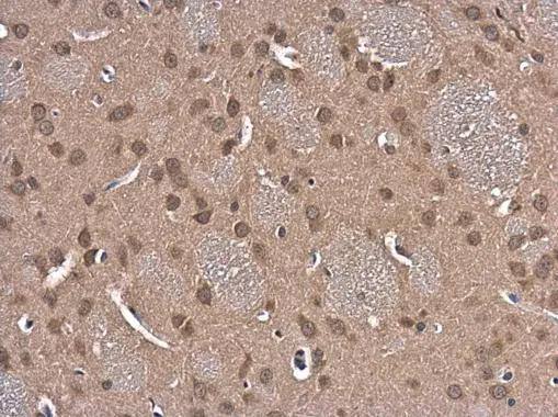 Immunohistochemistry-Paraffin Glutathione Reductase Antibody - BSA Free