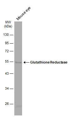 Mouse tissue extract (50 ug) was separated by 10% SDS-PAGE, and the membrane was blotted with Glutathione reductase (NBP2-16684) diluted at 1:1000. The HRP-conjugated anti-rabbit IgG antibody  was used to detect the primary antibody. 
