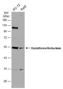 Various whole cell extracts (30 ug) were separated by 10% SDS-PAGE, and the membrane was blotted with Glutathione Reductase antibody (NBP2-16684) diluted at 1:1000. The HRP-conjugated anti-rabbit IgG antibody  was used to detect the primary antibody. 
