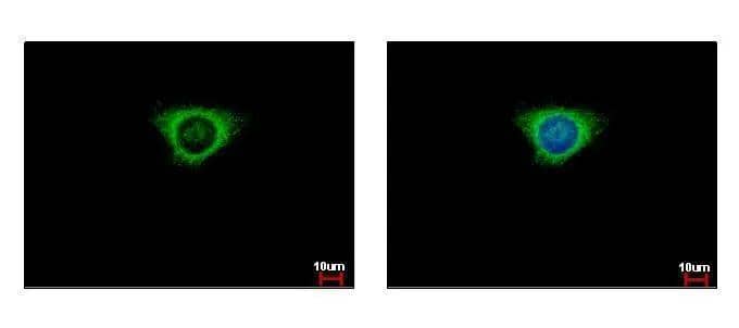 Immunocytochemistry/ Immunofluorescence Glutathione S Transferase kappa 1 Antibody