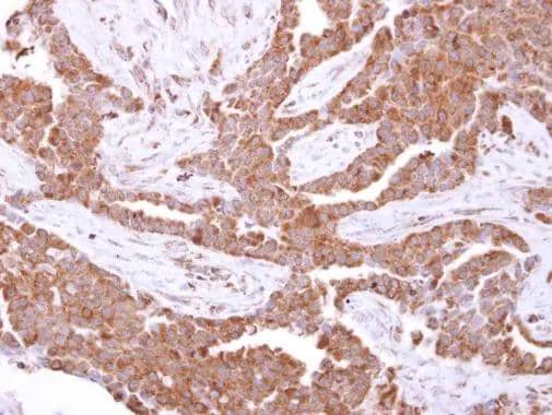 Immunohistochemistry Glutathione S Transferase kappa 1 Antibody - BSA Free