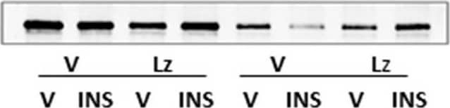 Western Blot: Glycogen phosphorylase, muscle form Antibody [NBP2-16689] - Region-based patterns of glycogen phosphorylase-muscle type (GPmm) Protein expression in icv Lz-pretreated male & female rats. GPmm protein was measured by Western blot in the rostral (a; F(7,40) = 35.87; p < 0.0001), middle (b; F(7,40) = 33.89; p < 0.0001), & caudal (c; F(7,40) = 9.43; p < 0.0001) VMN of V/V, V/INS, Lz/V, & Lz/INS groups of male (M; left-hand side) & female (F; right-hand side) rats. *p < 0.05; **p < 0.01; ***p < 0.001; ****p < 0.0001. For each VMN segment, data depict mean normalized GAD O.D. values ± S.E.M. Results are summarized in the table at bottom; ↑ & ↓ denote a relative increase or decrease, respectively, between treatment groups; no change (NC) between groups is also indicated Image collected & cropped by CiteAb from the following publication (//pubmed.ncbi.nlm.nih.gov/33238883), licensed under a CC-BY license. Not internally tested by Novus Biologicals.