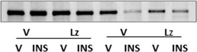 Western Blot: Glycogen phosphorylase, muscle form Antibody [NBP2-16689] - Region-based patterns of glycogen phosphorylase-muscle type (GPmm) Protein expression in icv Lz-pretreated male & female rats. GPmm protein was measured by Western blot in the rostral (a; F(7,40) = 35.87; p < 0.0001), middle (b; F(7,40) = 33.89; p < 0.0001), & caudal (c; F(7,40) = 9.43; p < 0.0001) VMN of V/V, V/INS, Lz/V, & Lz/INS groups of male (M; left-hand side) & female (F; right-hand side) rats. *p < 0.05; **p < 0.01; ***p < 0.001; ****p < 0.0001. For each VMN segment, data depict mean normalized GAD O.D. values ± S.E.M. Results are summarized in the table at bottom; ↑ & ↓ denote a relative increase or decrease, respectively, between treatment groups; no change (NC) between groups is also indicated Image collected & cropped by CiteAb from the following publication (//pubmed.ncbi.nlm.nih.gov/33238883), licensed under a CC-BY license. Not internally tested by Novus Biologicals.