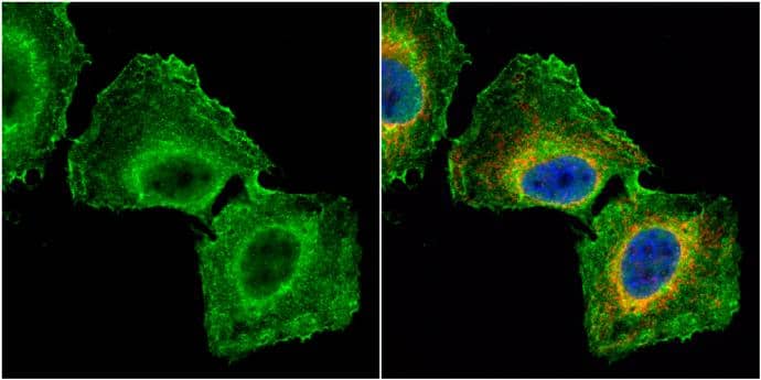 Immunocytochemistry/ Immunofluorescence GNB1 Antibody - BSA Free