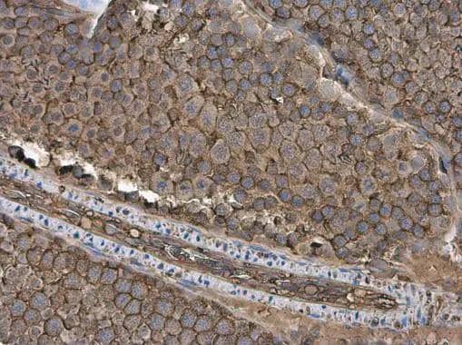 Immunohistochemistry-Paraffin GNB1 Antibody - BSA Free