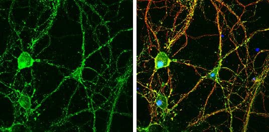 GNAO1 antibody detects GNAO1 protein by immunofluorescent analysis.Sample: DIV9 rat E18 primary hippocampal neuron cells were fixed in 4% paraformaldehyde at RT for 15 min.Green: GNAO1 stained by GNAO1 antibody (NBP2-16703) diluted at 1:500.Red: beta Tubulin 3/ Tuj1, stained by beta Tubulin 3/ Tuj1 antibody [GT1338]  diluted at 1:500.Blue: Fluoroshield with DAPI . 