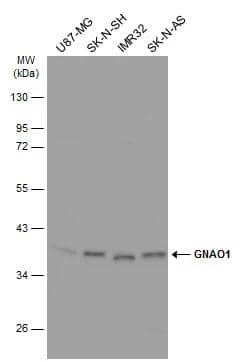 Various whole cell extracts (30 ug) were separated by 10% SDS-PAGE, and the membrane was blotted with GNAO1 antibody (NBP2-16703) diluted at 1:1000. The HRP-conjugated anti-rabbit IgG antibody  was used to detect the primary antibody. 