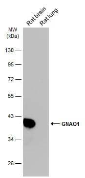Various tissue extracts (50 ug) were separated by 10% SDS-PAGE, and the membrane was blotted with GNAO1 antibody (NBP2-16703) diluted at 1:10000. The HRP-conjugated anti-rabbit IgG antibody  was used to detect the primary antibody. 