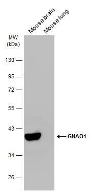 Various tissue extracts (50 ug) were separated by 10% SDS-PAGE, and the membrane was blotted with GNAO1 antibody (NBP2-16703) diluted at 1:10000. The HRP-conjugated anti-rabbit IgG antibody  was used to detect the primary antibody. 