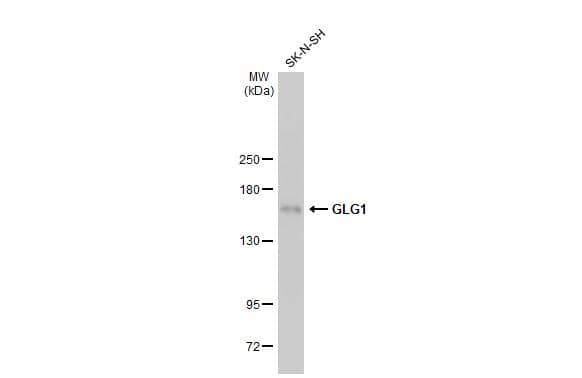 Whole cell extract (30 ug) was separated by 5% SDS-PAGE, and the membrane was blotted with GLG1 antibody [C2C3], C-term (NBP2-16704) diluted at 1:1000. The HRP-conjugated anti-rabbit IgG antibody  was used to detect the primary antibody. 