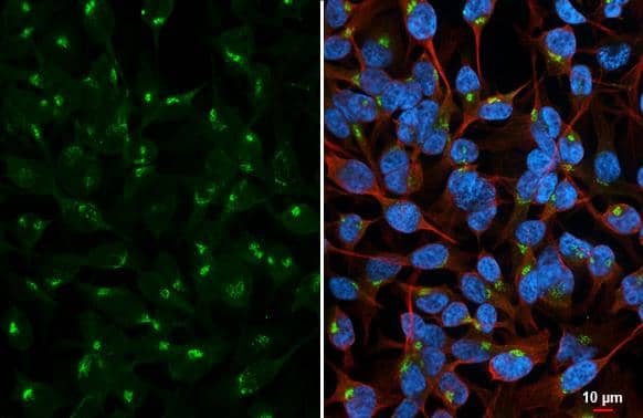 Golgin 97 antibody [C2C3], C-term detects Golgin 97 protein by immunofluorescent analysis.Sample: HeLa cells were fixed in 4% paraformaldehyde at RT for 15 min.Green: Golgin 97 stained by Golgin 97 antibody [C2C3], C-term (NBP2-16705) diluted at 1:500.Red: alpha Tubulin, a cytoskeleton marker, stained by alpha Tubulin antibody [GT114]  diluted at 1:1000.Blue: Fluoroshield with DAPI . 