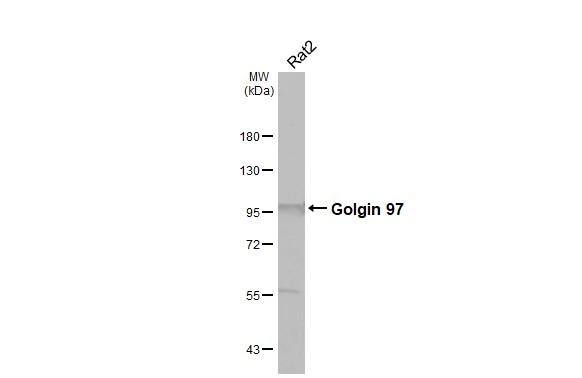 Whole cell extract (30 ug) was separated by 7.5% SDS-PAGE, and the membrane was blotted with Golgin 97 antibody [C2C3], C-term (NBP2-16705) diluted at 1:1000. The HRP-conjugated anti-rabbit IgG antibody  was used to detect the primary antibody. 