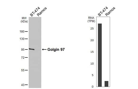 Various whole cell extracts (30 ug) were separated by 7.5% SDS-PAGE, and the membrane was blotted with Golgin 97 antibody [C2C3], C-term (NBP2-16705) diluted at 1:1000. The HRP-conjugated anti-rabbit IgG antibody  was used to detect the primary antibody. Corresponding RNA expression data are based on Human Protein Atlas program. 