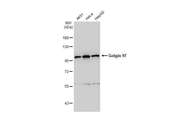Various whole cell extracts (30 ug) were separated by 7.5% SDS-PAGE, and the membrane was blotted with Golgin 97 antibody [C2C3], C-term (NBP2-16705) diluted at 1:1000. The HRP-conjugated anti-rabbit IgG antibody  was used to detect the primary antibody. 