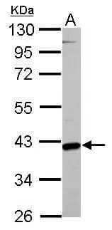 GOT2 antibody detects GOT2 protein by western blot analysis.A. 30 ug Neuro2A whole cell lysate/extract 10% SDS-PAGEGOT2 antibody (NBP2-16708) dilution: 1:1000 The HRP-conjugated anti-rabbit IgG antibody  was used to detect the primary antibody. 