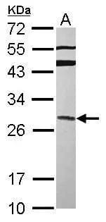 Sample (30 ug of whole cell lysate)  A: MCF-7  12% SDS PAGE  NBP2-16737 diluted at 1:2000  