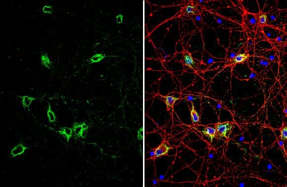 Grp78 antibody detects Grp78 protein by immunofluorescent analysis.Sample: DIV10 rat E18 primary cortical neuron cells were fixed in 4% paraformaldehyde at RT for 15 min.Green: Grp78 stained by Grp78 antibody (NBP2-16749) diluted at 1:500.Red: Tau, stained by Tau antibody [GT287]  diluted at 1:500.Blue: Fluoroshield with DAPI . 