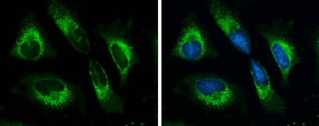 Grp78 antibody detects Grp78 protein at cytoplasm by immunofluorescent analysis.Sample: HeLa cells were fixed in ice-cold MeOH for 5 min.Green: Grp78 protein stained by Grp78 antibody (NBP2-16749) diluted at 1:500.Blue: Hoechst 33342 staining. 