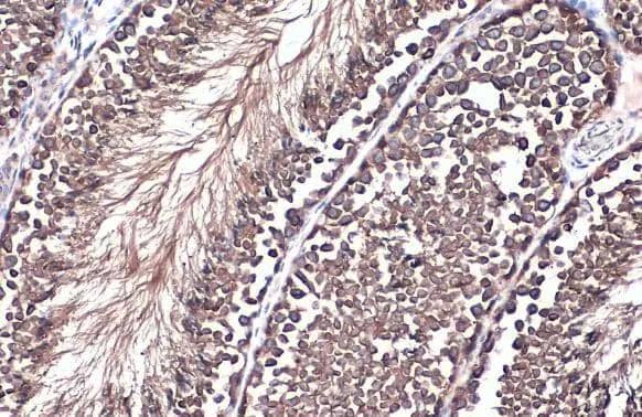 Grp78 antibody detects Grp78 protein at cytoplasm by immunohistochemical analysis.Sample: Paraffin-embedded mouse testis.Grp78 stained by Grp78 antibody (NBP2-16749) diluted at 1:500.Antigen Retrieval: Citrate buffer, pH 6.0, 15 min 