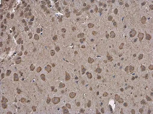 Grp78 antibody detects Grp78 protein at cytoplasm in mouse brain by immunohistochemical analysis. Sample: Paraffin-embedded mouse brain. Grp78 antibody (NBP2-16749) diluted at 1:250. br>Antigen Retrieval: Citrate buffer, pH 6.0, 15 min 