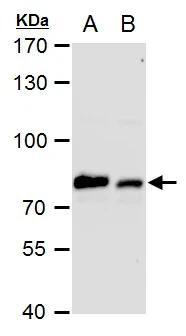 Grp78 antibody detects Grp78 protein by western blot analysis.A. 30 ug PC-12 whole cell extract B. 30 ug Rat2 whole cell extract7.5% SDS-PAGEGrp78 antibody (NBP2-16749) dilution: 1:10000 The HRP-conjugated anti-rabbit IgG antibody  was used to detect the primary antibody. 