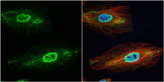 Immunocytochemistry/ Immunofluorescence Glutathione S-Transferase pi 1/GSTP1 Antibody - BSA Free