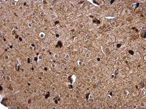 Immunohistochemistry Glutathione S-Transferase pi 1/GSTP1 Antibody - BSA Free