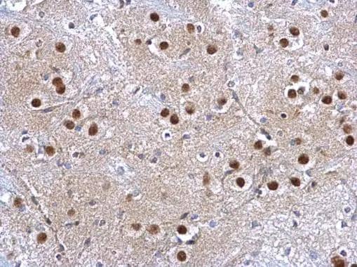 Immunohistochemistry Glutathione S-Transferase pi 1/GSTP1 Antibody - BSA Free