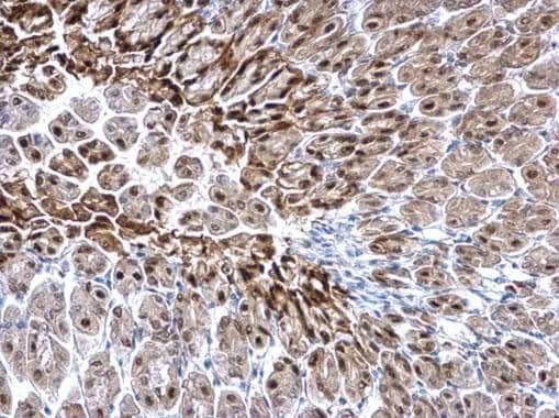 Immunohistochemistry Glutathione S-Transferase pi 1/GSTP1 Antibody - BSA Free