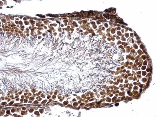 Immunohistochemistry Glutathione S-Transferase pi 1/GSTP1 Antibody - BSA Free