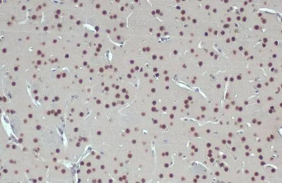 Immunohistochemistry-Paraffin Glutathione S-Transferase pi 1/GSTP1 Antibody - BSA Free