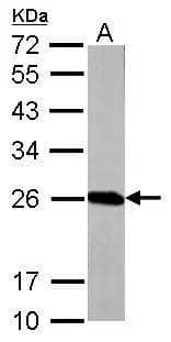 Western Blot Glutathione S-Transferase pi 1/GSTP1 Antibody - BSA Free