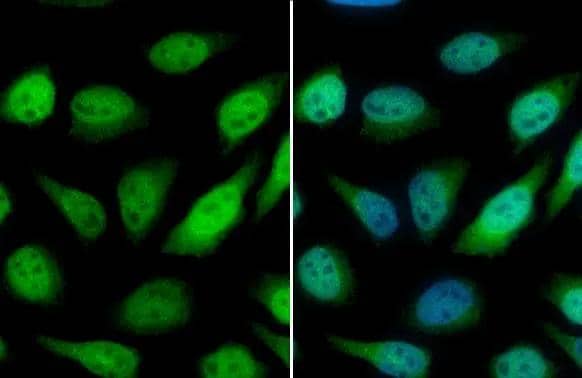 GSTP1 antibody detects GSTP1 protein at cytoplasm and nucleus by immunofluorescent analysis.Sample: HeLa cells were fixed in 4% paraformaldehyde at RT for 15 min.Green: GSTP1 stained by GSTP1 antibody (NBP2-16757) diluted at 1:500.Blue: Fluoroshield with DAPI . 