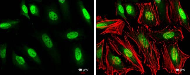 GTF2H1 antibody [N1C1] detects GTF2H1 protein at nucleus by immunofluorescent analysis.Sample: HeLa cells were fixed in 4% paraformaldehyde at RT for 15 min.Green: GTF2H1 stained by GTF2H1 antibody [N1C1] (NBP2-16761) diluted at 1:500.Red: phalloidin, a cytoskeleton marker, diluted at 1:100.Scale bar= 10um. 