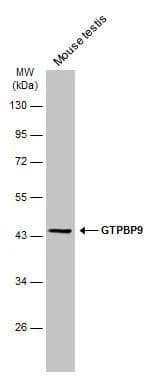 Mouse tissue extract (50 ug) was separated by 10% SDS-PAGE, and the membrane was blotted with GTPBP9 antibody [C1C3] (NBP2-16767) diluted at 1:1000. The HRP-conjugated anti-rabbit IgG antibody  was used to detect the primary antibody. 