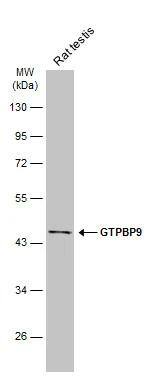 Rat tissue extract (50 ug) was separated by 10% SDS-PAGE, and the membrane was blotted with GTPBP9 antibody [N1C1] (NBP2-16768) diluted at 1:1000. The HRP-conjugated anti-rabbit IgG antibody  was used to detect the primary antibody. 