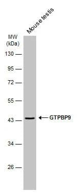 Mouse tissue extract (50 ug) was separated by 10% SDS-PAGE, and the membrane was blotted with GTPBP9 antibody [N1C1] (NBP2-16768) diluted at 1:1000. The HRP-conjugated anti-rabbit IgG antibody  was used to detect the primary antibody. 