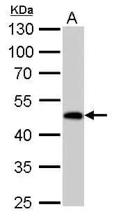 Guanine deaminase antibody detects Guanine deaminase protein by Western blot analysis.A. 50 ug rat colon lysate/extract 10 % SDS-PAGEGuanine deaminase antibody (NBP2-16769) dilution: 1:1000 