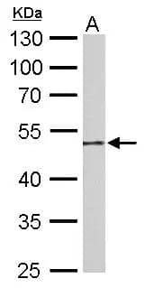 Guanine deaminase antibody detects Guanine deaminase protein by Western blot analysis.A. 50 ug mouse colon lysate/extract 10 % SDS-PAGEGuanine deaminase antibody (NBP2-16769) dilution: 1:1000 